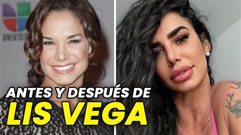 lis vega antes y después|El increíble antes y después de Lis Vega en candentes fotos